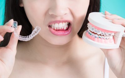 Invisalign vs. Traditional Braces: Which is Right for You?