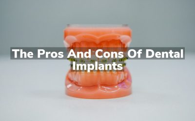 The Pros and Cons of Dental Implants