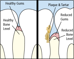 Periodontal Treatment in Tenafly NJ